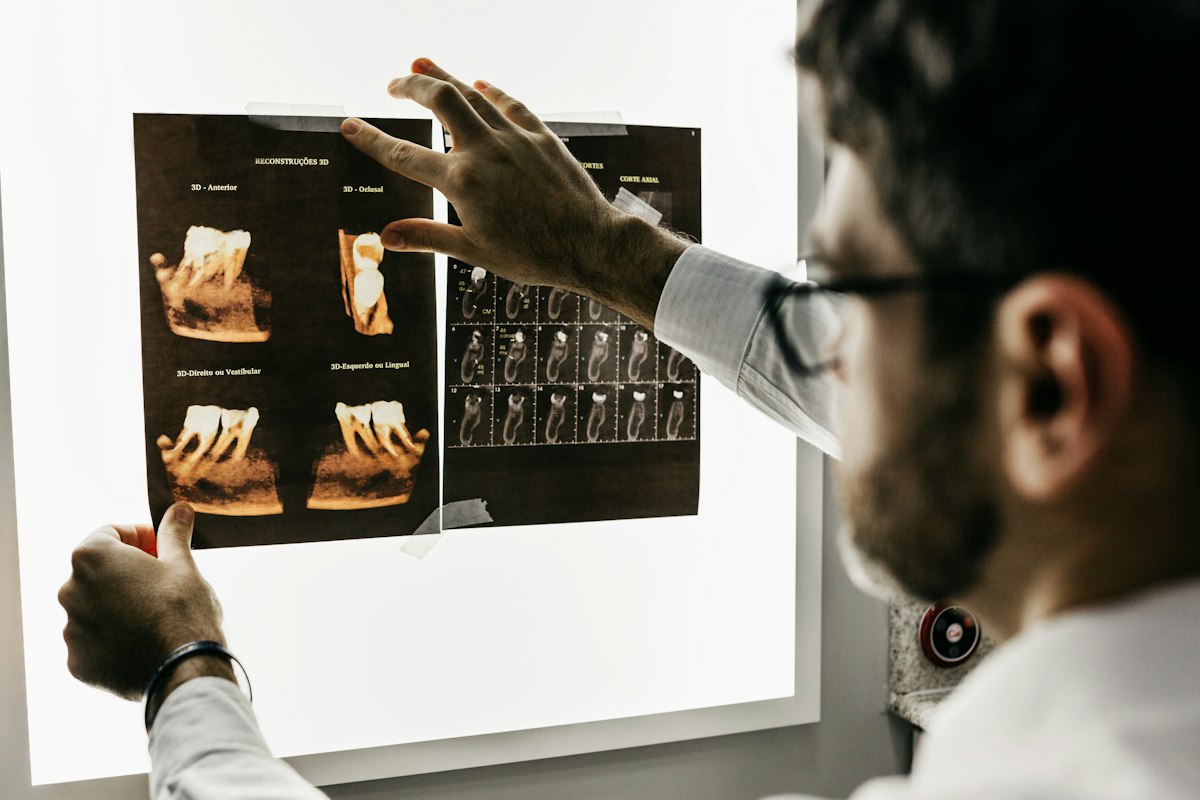 Panoramic dental X-ray